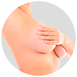 Эндоскопическое увеличение груди