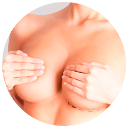 Подтяжка груди после родов