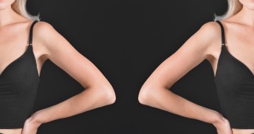 Фото увеличения груди до и после: чек-лист оценки результатов по снимкам, как отличить реальные результаты и на что обратить внимание